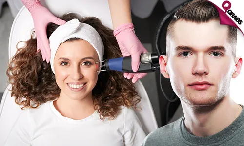 CO2 Fractional Laser & Q-Switch Carbon Peel for Ladies & Men!